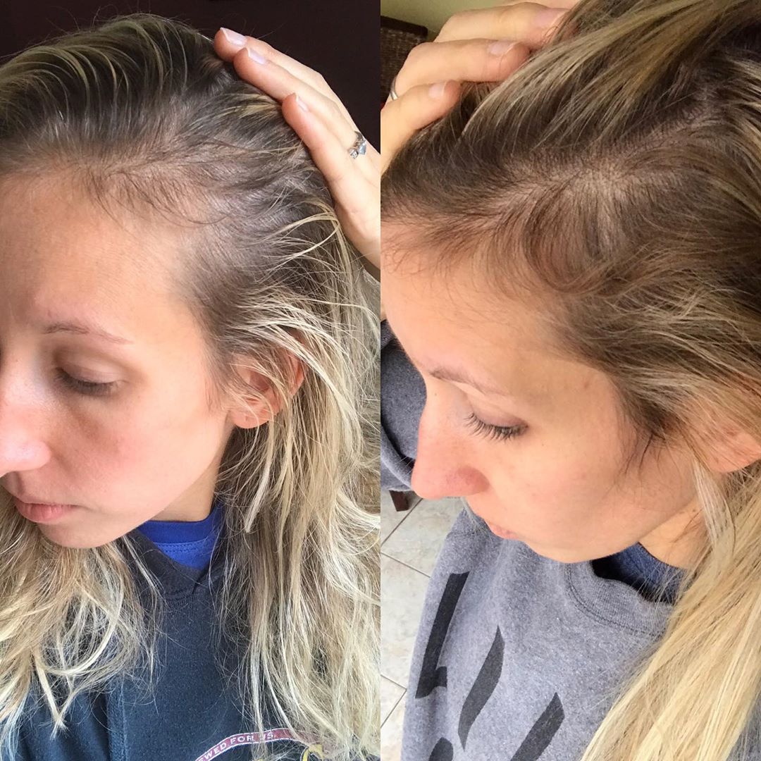 Hair Thickening Spray Before After
