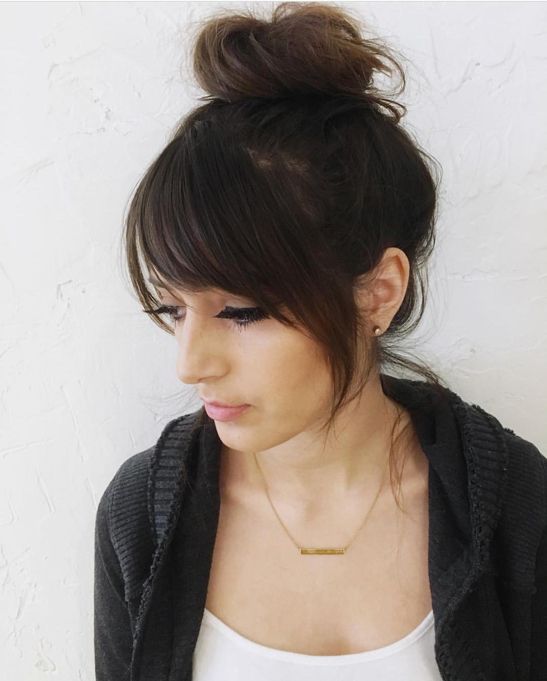 Very Thin Hair at Temples