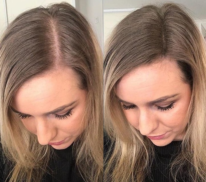 Cotton Fibers for Very Thin Hair