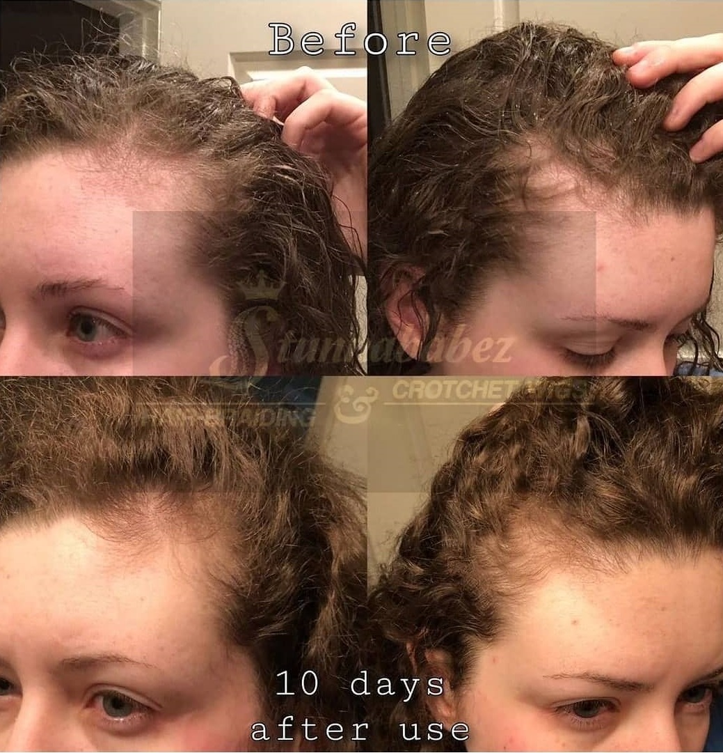 rice water for hair effect and benefits