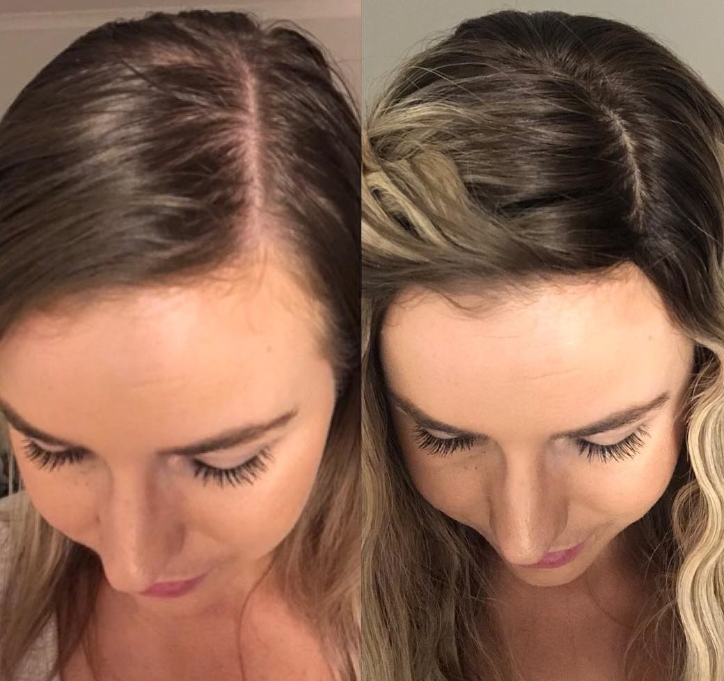 Topper for Really Thin Hair