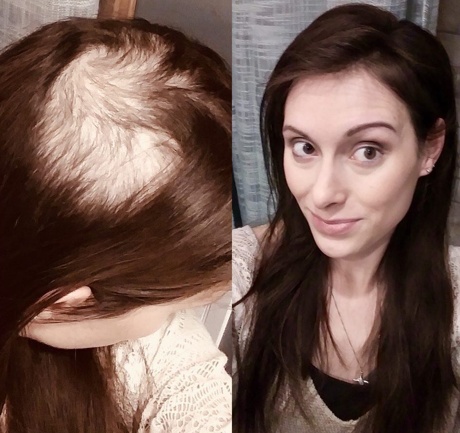 Topper for Women with Very Thin Hair